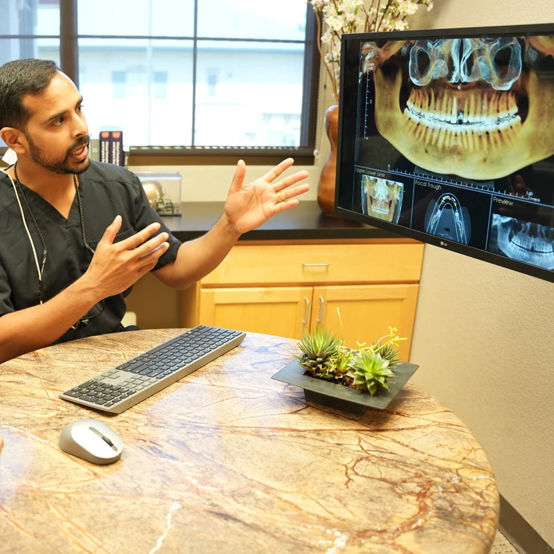 Benefit Of Dental Implant