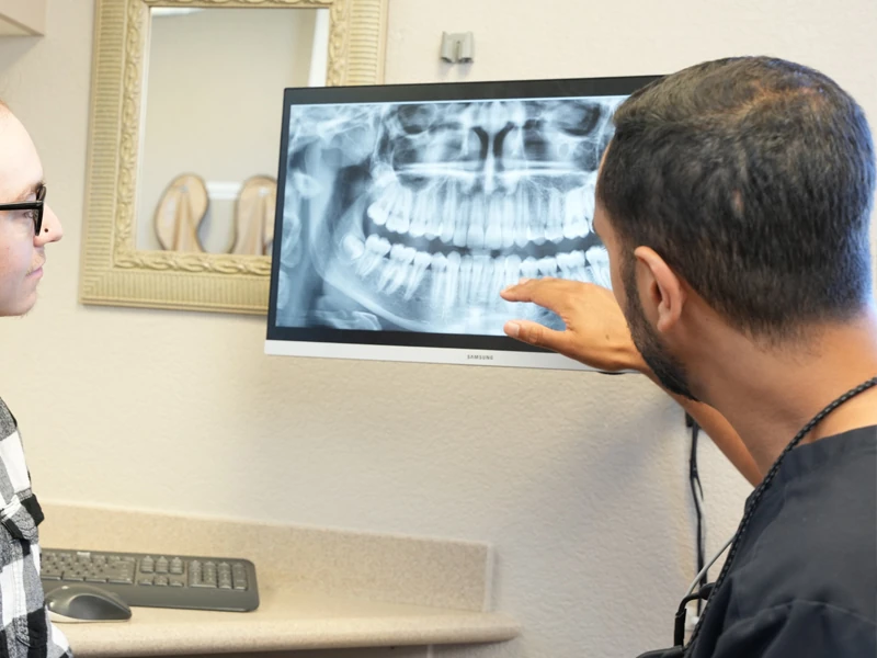 Symptoms And Risks Gum Recession