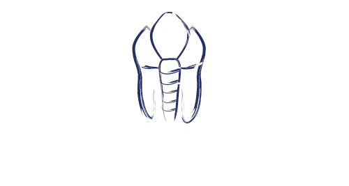 Foundation Implants