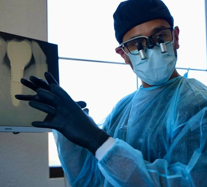 Surgical Molar Extraction Understanding The Process